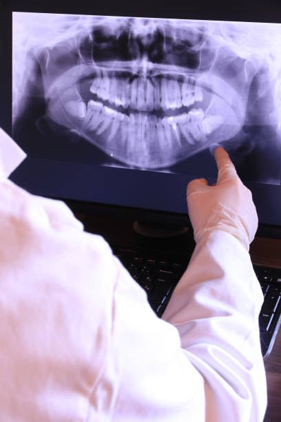 Best Emergency Wisdom Teeth Removal in Bethesda, OH